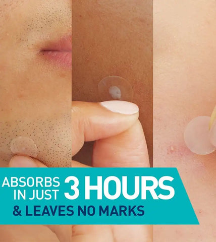 Blemish Barrier Patches