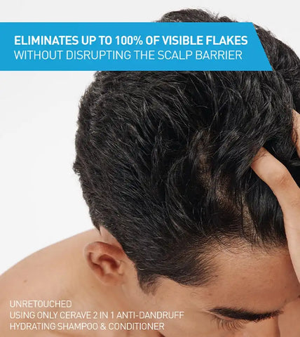 2-in-1 Anti-Dandruff Hydrating Shampoo and Conditioner