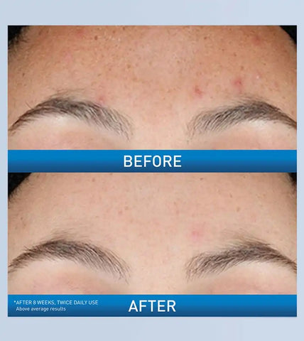Resurfacing Retinol Serum