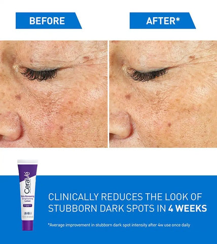 Skin Renewing Brightening Lotion with SPF 30